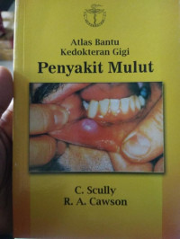 Image of ATLAS BANTU KEDOKTERAN GIGI : PENYAKIT MULUT
