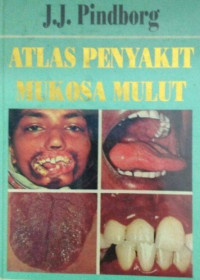 Image of Atlas penyakit mukosa mulut