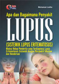 Image of Apa Dan Bagaimana Penyakit Lupus ( Sistem Lupus Eritmatosus ) Makna Hidup Penderita Yang Terdiagnosa Lupus Eritmatosus Sistemic Dengan Prespektip Maslow & Hendeson